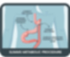SLIMMS Metabolic Procedure - Step 3