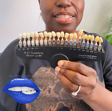 teeth whitening
