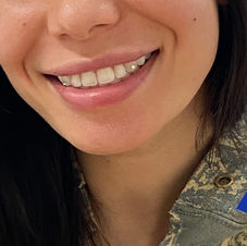 tooth gems