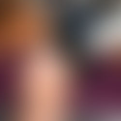 Needle-Free Hair Vitality Ampule Treatment