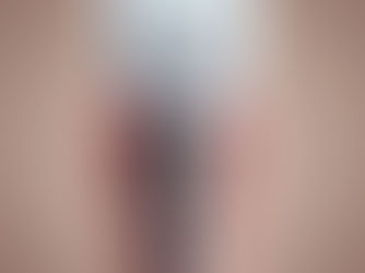 Dental implant cross-section showing a metallic screw embedded in gum tissue with a white crown on top. Background is beige.