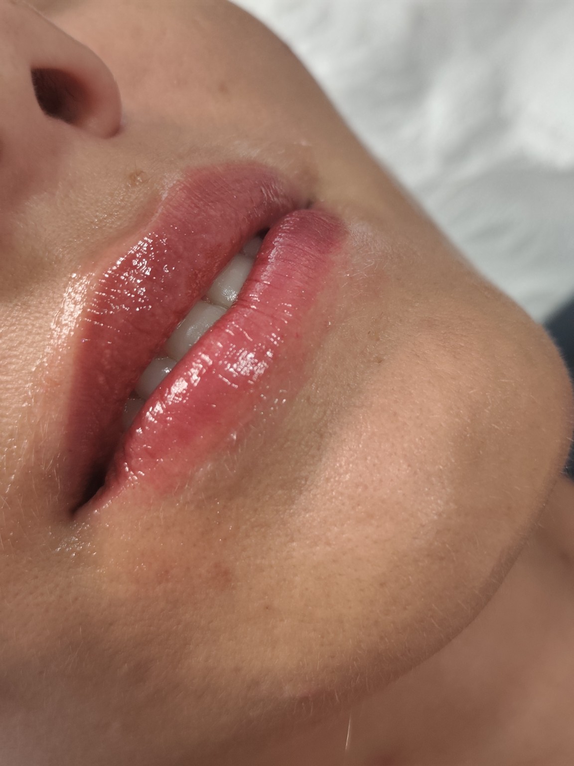 Hydra Lips nega usana