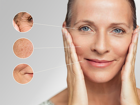 IMG 13 Reitalizacion facial.png