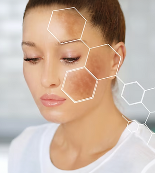 IMG 7 Despigmentante.png