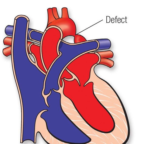 Missed Minutes Can Mean Millions...