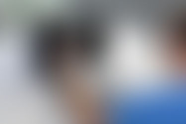 The Power of Precision: Why Surgical Guides Reign Supreme in Dental Implants