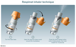 Respirmat Inhaler | ©UWorld, LLC | 2022