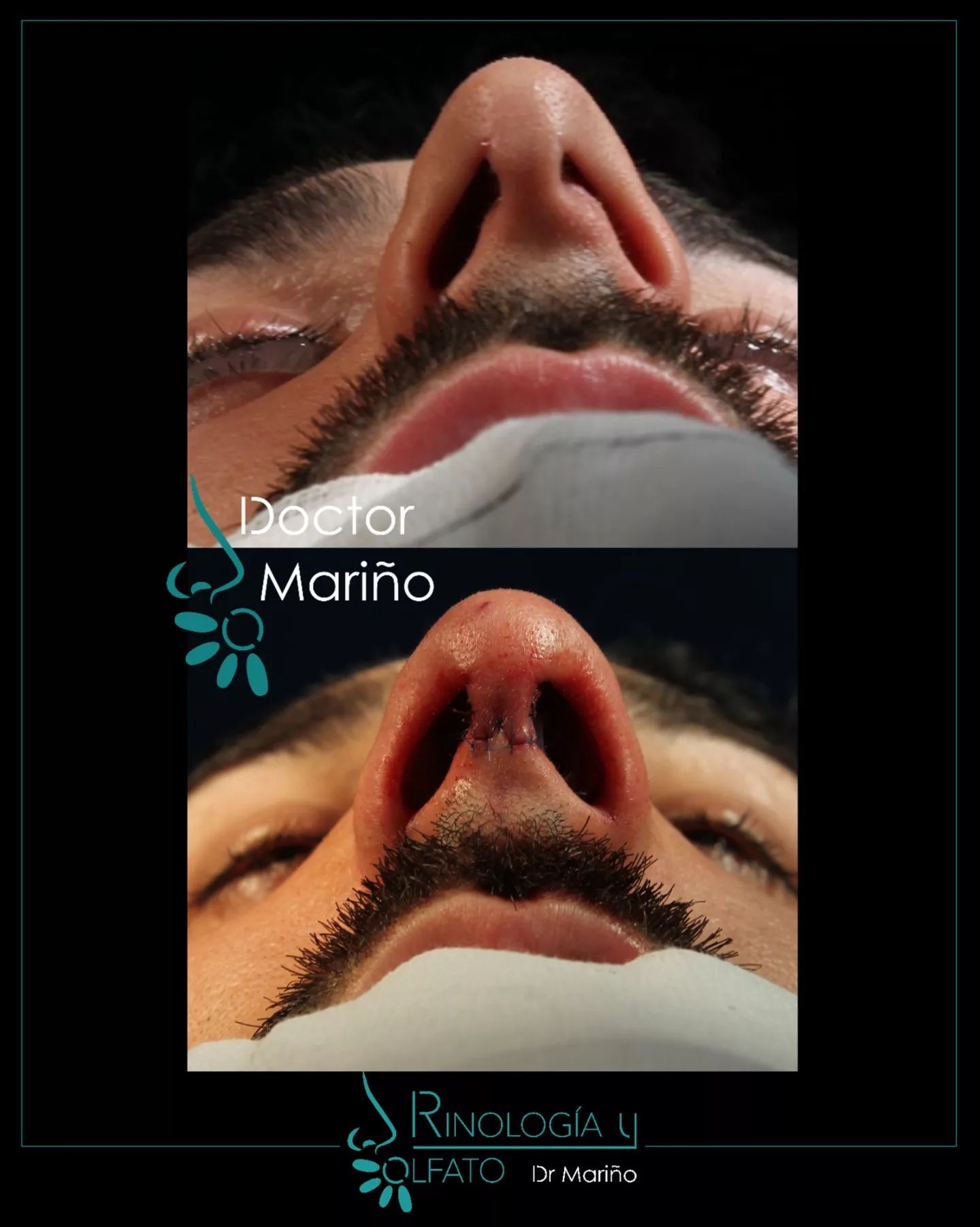 17932437710173445