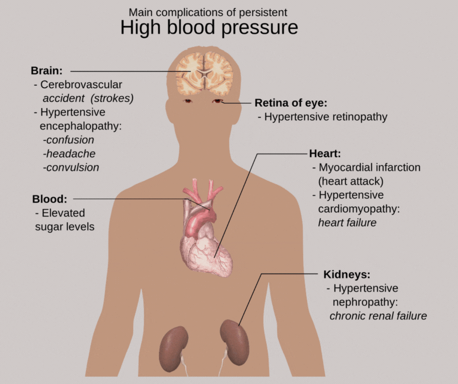 Joseph R. Giove Clinical Hypnosis | San Francisco Bay Area