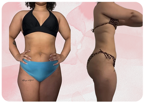 woman after weightloss transformation