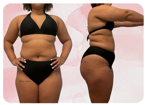 Woman before losing 31 lbs