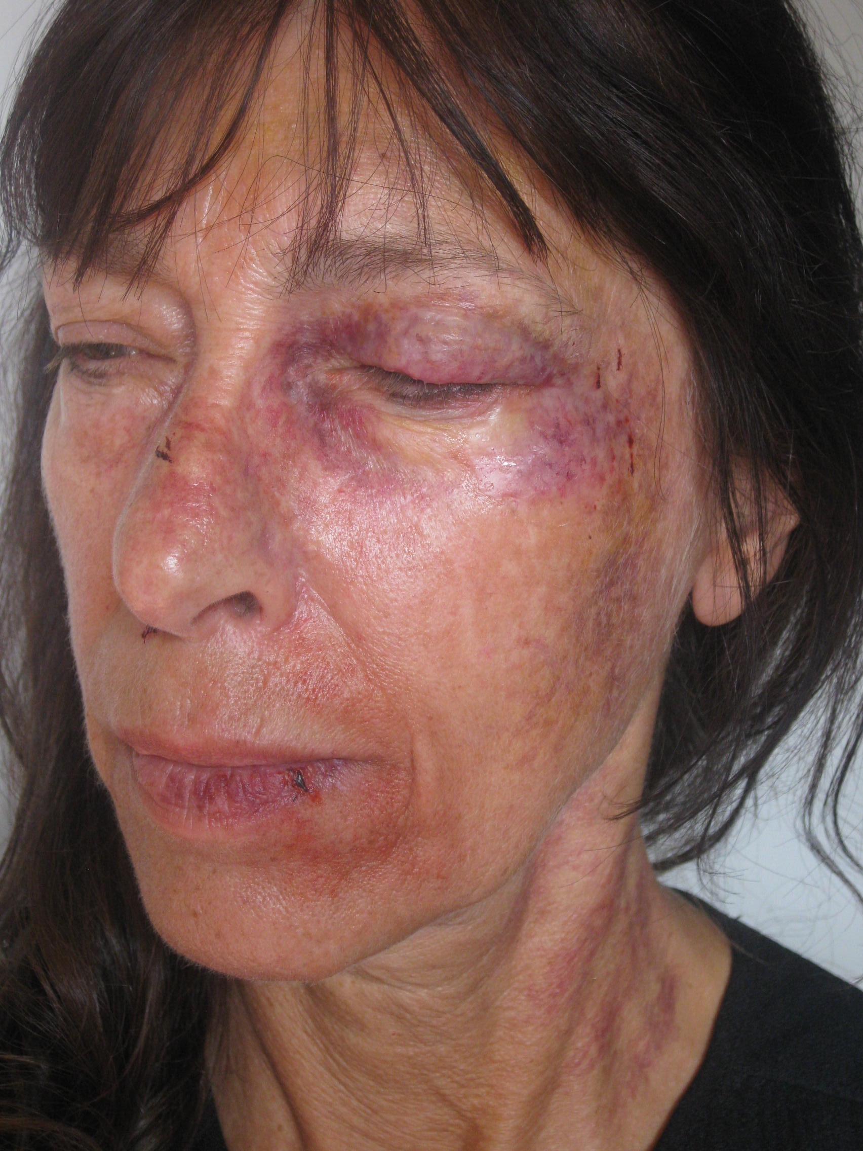 'Beaten wife' makeup test