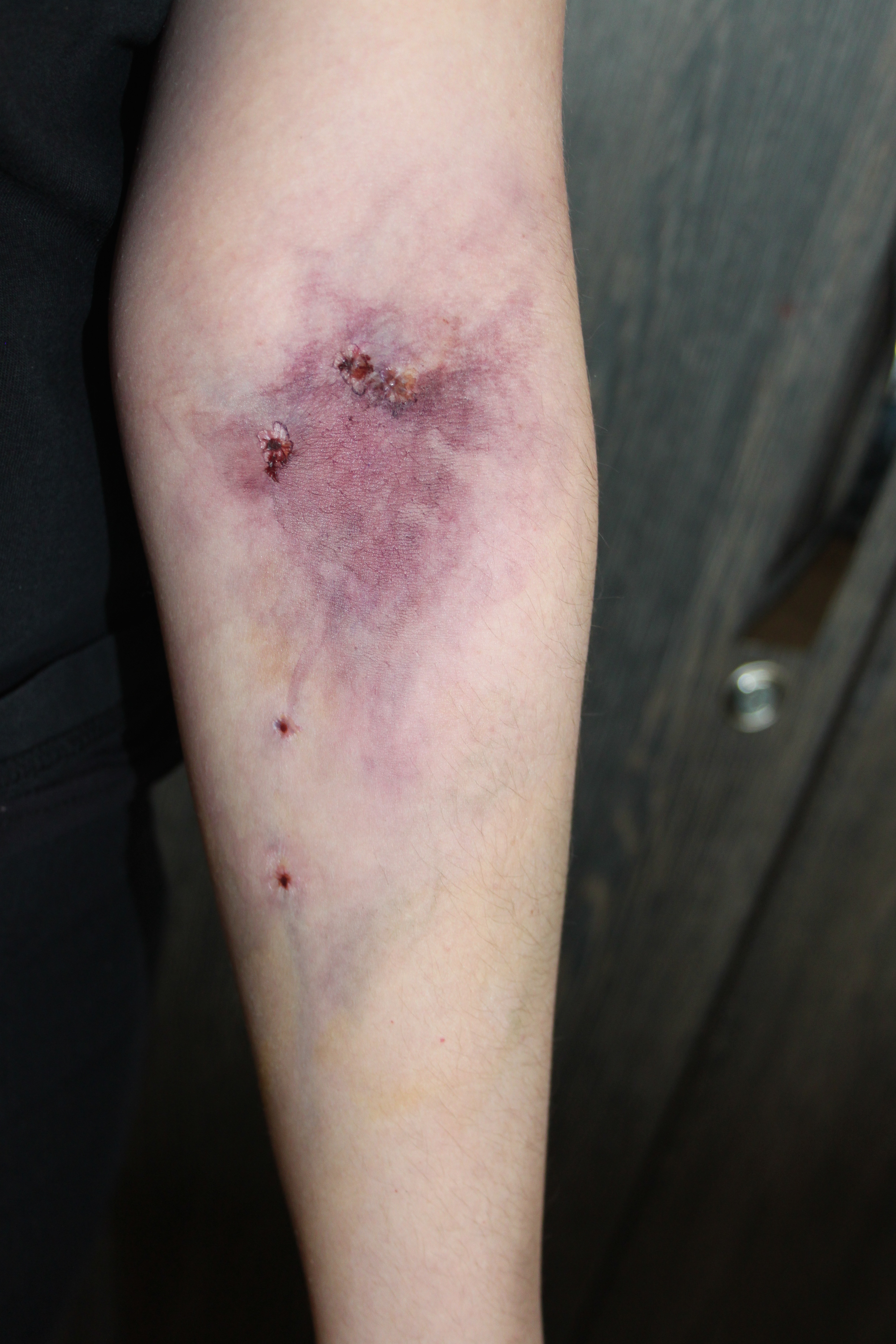 Infected track mark test
