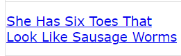 She Has Six Toes That Look Like Sausage Worms (CODE CRACK)