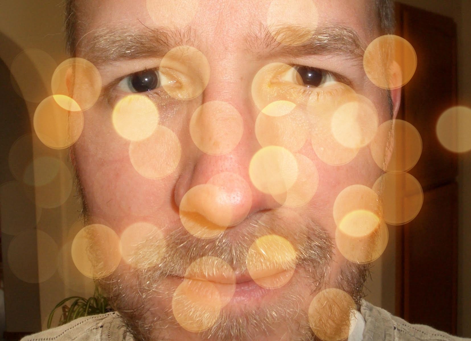 Blurry Vision, Numbness, Cog Fog ActiveMSers