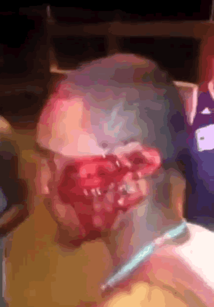 Cut to the side of the head