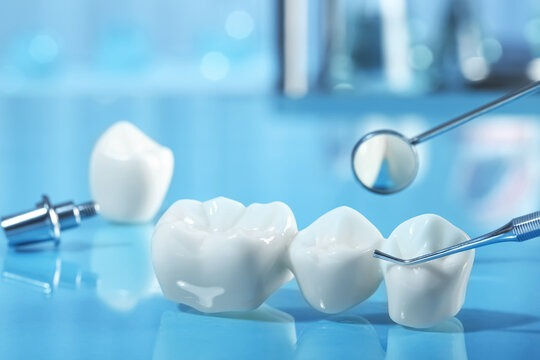 Why This Dental Crowns Treatment in NYC Is Often Recommended by Patients