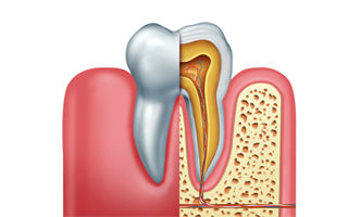 root-canal-dentist-11735.jpg