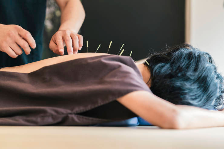 Acupuncture effects