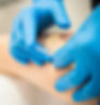dry needling