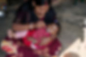 Addressing Maternal Undernutrition: A Critical Issue Affecting Women's Health