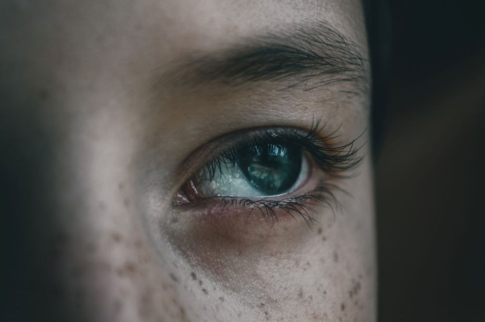 face with freckles