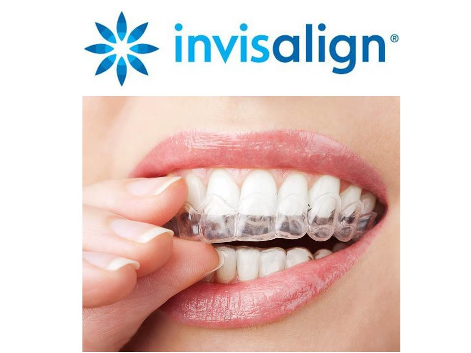 Invisalign