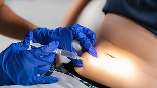 lipolysis-treatment-of-adipose-tissue-G9NUTLJ.jpg