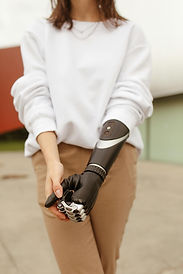 Woman with a prosthetic arm, symbolizing confidence, resilience, and adaptability, as highlighted by Amputees Are Awesome.