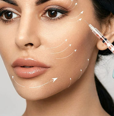 Juvederm dermal filler calgary