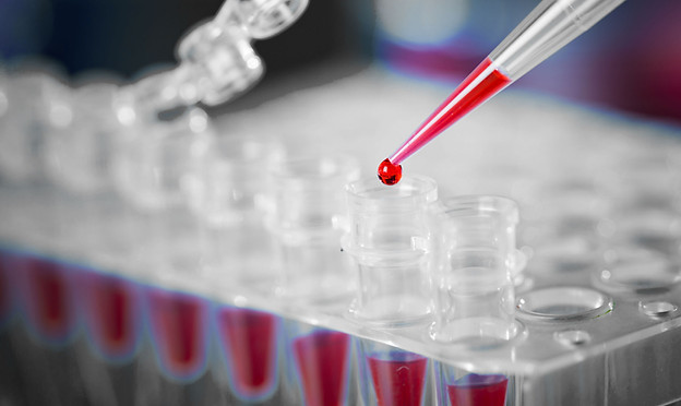Blood Sample