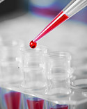Blood Sample for IV Therapy