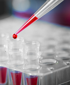 A dropper putting blood into a test tube. Paternity is a complicated issue. If you are a man or a woman, know the true paternity of a child is vital. DNA testing reveals the truth, but it is a complicated process to establish legal rights and obligations once the father is found. Ruppert Law Firm helps men and women with paterntity issues in Pittsburgh, Moon, Cranberry, Irwin, Greensburg, Butler, Washington, and throughout the area.