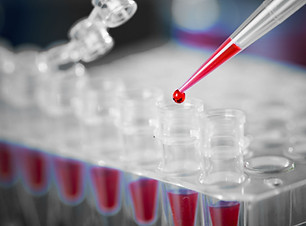 Blood Sample