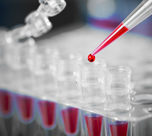 Blood Sample