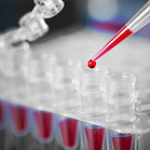 Blood Sample