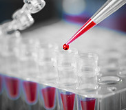 CRD - Component-Resolved Diagnosis - Dra Marcia Toraiwa explica