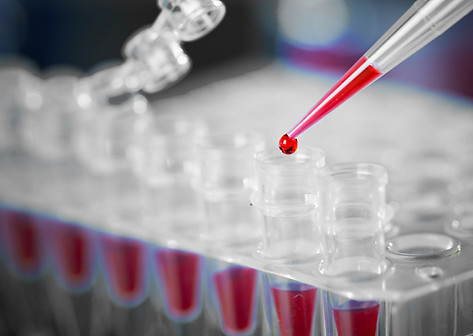 Genetic Testing