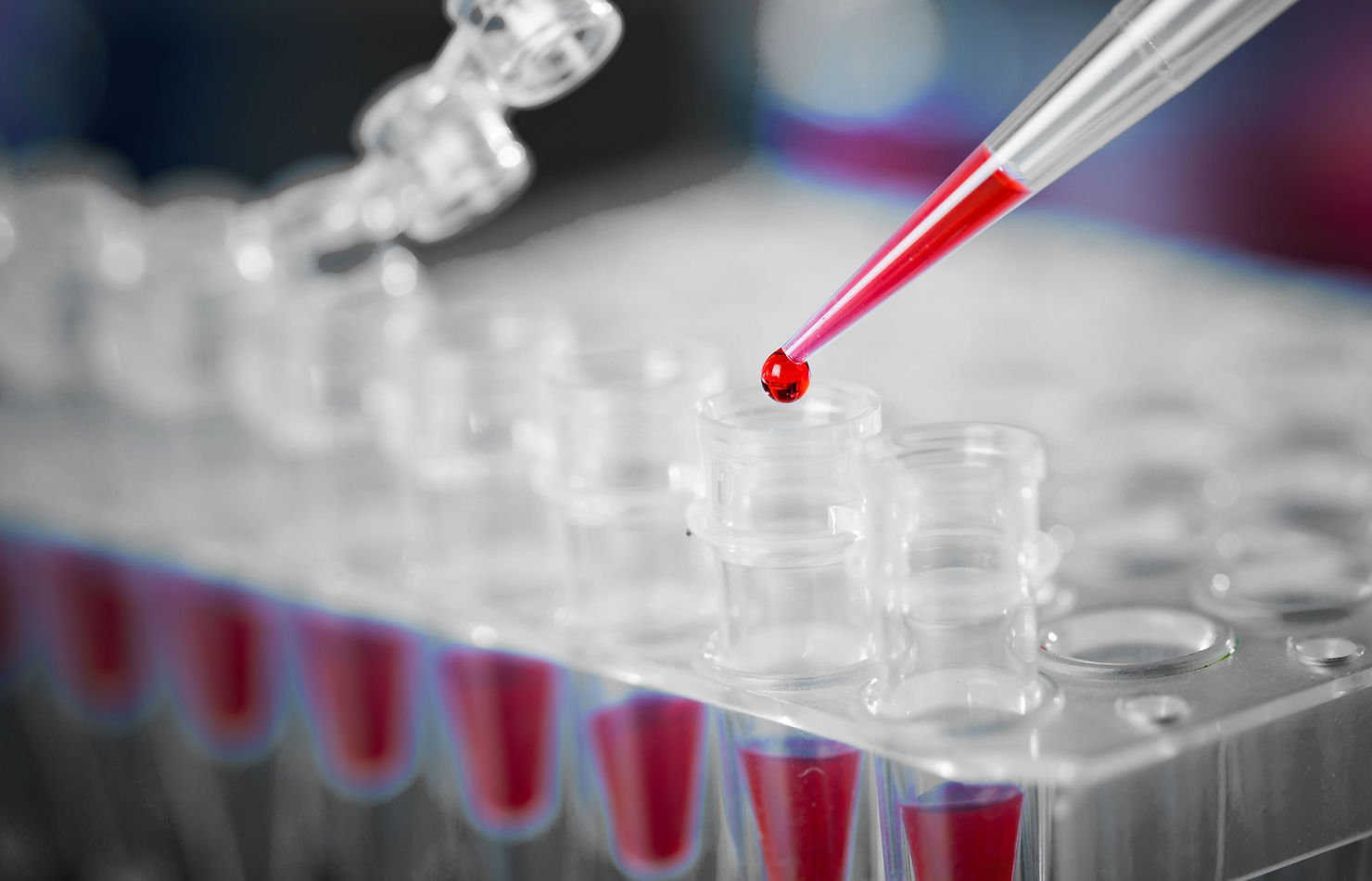 Myelofibrosis (MF)