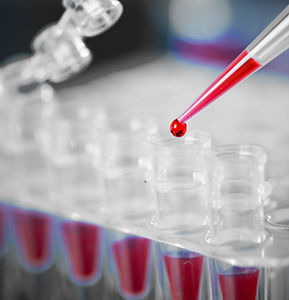 Blood Sample