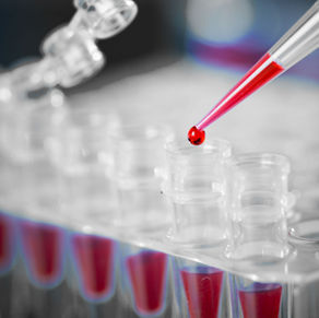 Manchas de sangue em locais de crime