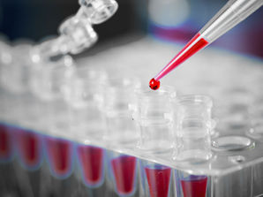 Hermes Pardini compra laboratório APC por R$ 19,5 milhões