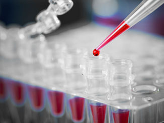 Anemia natural cure