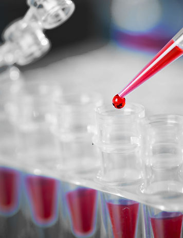 Covid-19 antibody testing