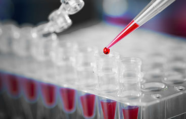 DNA Testing, DNA Expert Report