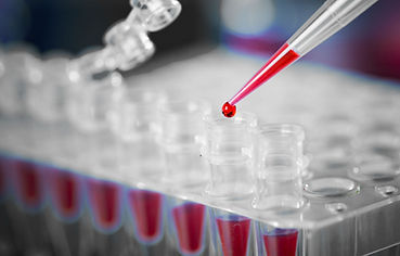 DNA Testing, DNA Expert Report
