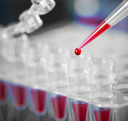 Manhattan Internal Medicine Associates's doctor taking a sample of blood to test for hematology.