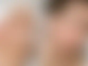 Does Dermaplaning Cause Breakouts?