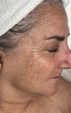 Beige Minimalist Skincare Before and After Instagram Post_edited.jpg