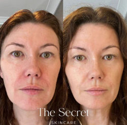 Australian Skincare – The Secret Skincare and 4 more pages - Personal - Microsoft Edge 29